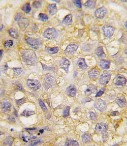 Invitrogen EphB2 Polyclonal Antibody 400 &mu;L; Unconjugated:Antibodies,