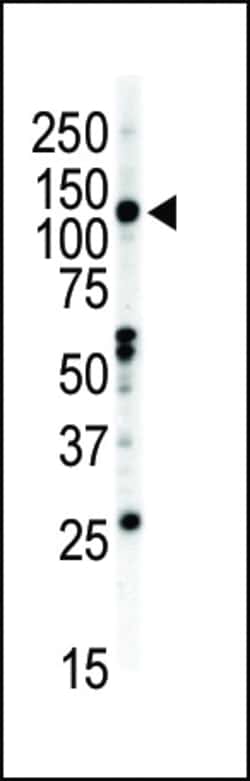 Invitrogen EphB2 Polyclonal Antibody 400 &mu;L; Unconjugated:Antibodies,