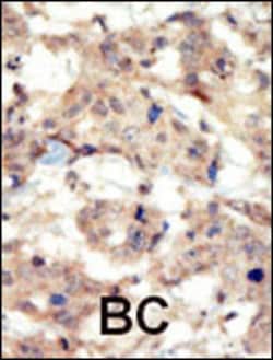 Invitrogen EphB6 Polyclonal Antibody 400 &mu;L; Unconjugated:Antibodies,