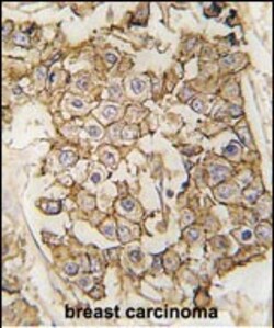 Invitrogen ErbB2 (HER-2) Polyclonal Antibody 400 &mu;L | Buy Online | Invitrogen&trade; | Fisher Scientific