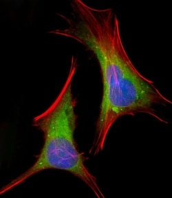 Invitrogen FGFR2 Polyclonal Antibody 400 &mu;L | Buy Online | Invitrogen&trade; | Fisher Scientific