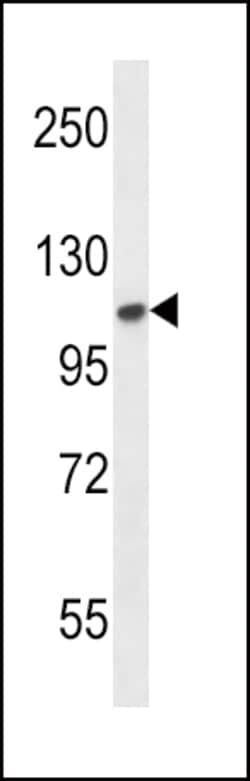 Invitrogen FGFR2 Polyclonal Antibody 400 &mu;L | Buy Online | Invitrogen&trade; | Fisher Scientific