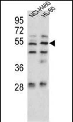 Invitrogen SESN1 Polyclonal Antibody 400 &mu;L; Unconjugated:Antibodies,