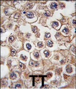 Invitrogen INSRR Polyclonal Antibody 400 &mu;L; Unconjugated:Antibodies,