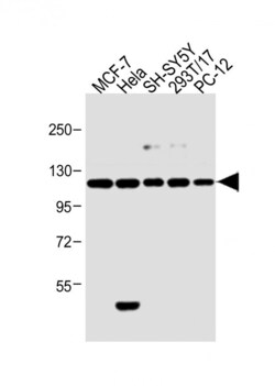 Invitrogen INSRR Polyclonal Antibody 400 &mu;L; Unconjugated:Antibodies,