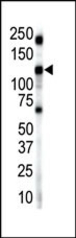 Invitrogen INSRR Polyclonal Antibody 400 &mu;L; Unconjugated:Antibodies,