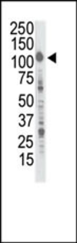 Invitrogen INSRR Polyclonal Antibody 400 &mu;L | Buy Online | Invitrogen&trade; | Fisher Scientific