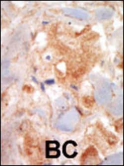 Invitrogen c-Kit Polyclonal Antibody 400 &mu;L; Unconjugated:Antistoffer
