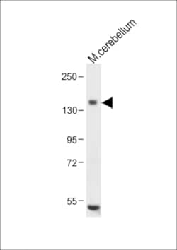 Invitrogen c-Kit Polyclonal Antibody 400 &mu;L; Unconjugated:Antistoffer