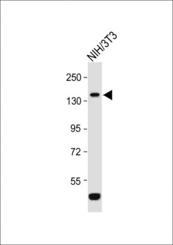 Invitrogen ROR1 Polyclonal Antibody 400 &mu;L; Unconjugated:Antibodies,