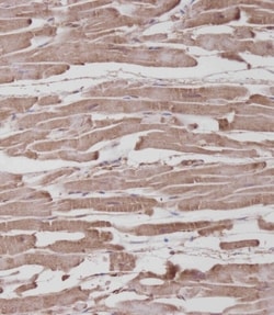 Invitrogen ROR1 Polyclonal Antibody 200 &mu;L; Unconjugated:Antibodies,