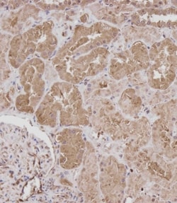 Invitrogen ROR1 Polyclonal Antibody 200 &mu;L; Unconjugated:Antibodies,