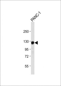Invitrogen ROR1 Polyclonal Antibody 200 &mu;L; Unconjugated:Antibodies,