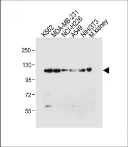 Invitrogen ROR1 Polyclonal Antibody 200 &mu;L; Unconjugated:Antibodies,