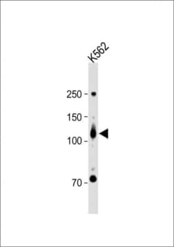 Invitrogen ROR2 Polyclonal Antibody 400 &mu;L; Unconjugated:Antibodies,