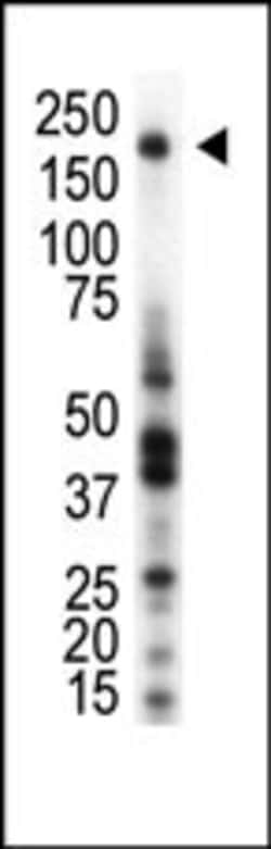Invitrogen RON Polyclonal Antibody 400 &mu;L; Unconjugated:Antibodies,