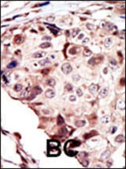 Invitrogen RYK Polyclonal Antibody 400 &mu;L; Unconjugated:Antibodies,