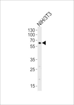 Invitrogen RYK Polyclonal Antibody 400 &mu;L; Unconjugated:Antibodies,