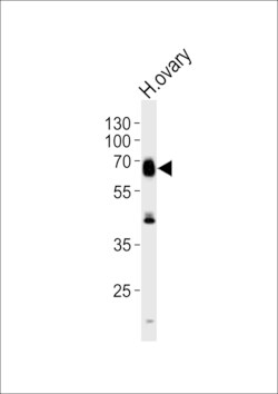Invitrogen RYK Polyclonal Antibody 400 &mu;L; Unconjugated:Antibodies,