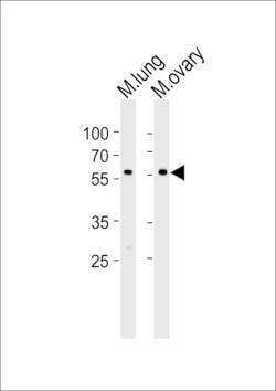 Invitrogen RYK Polyclonal Antibody 400 &mu;L; Unconjugated:Antibodies,