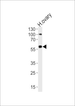Invitrogen RYK Polyclonal Antibody 400 &mu;L; Unconjugated:Antibodies,