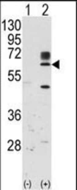 Invitrogen RYK Polyclonal Antibody 400 &mu;L; Unconjugated:Antibodies,