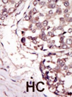 Invitrogen RYK Polyclonal Antibody 400 &mu;L; Unconjugated:Antibodies,