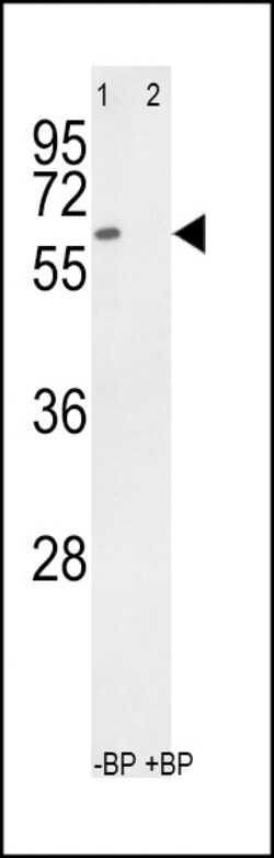 Invitrogen RYK Polyclonal Antibody 400 &mu;L; Unconjugated:Antibodies,
