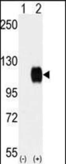 Invitrogen TYRO3 Polyclonal Antibody 400 &mu;L | Buy Online | Invitrogen&trade; | Fisher Scientific