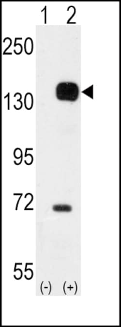 Invitrogen TEK Polyclonal Antibody 400 μL; Unconjugated:Antibodies,