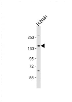 Invitrogen TrkA Polyclonal Antibody 400 &mu;L; Unconjugated:Antibodies,