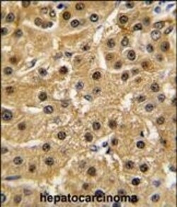 Invitrogen c-Abl Polyclonal Antibody 400 &mu;L; Unconjugated:Antibodies,