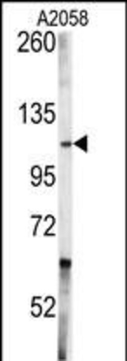 Invitrogen c-Abl Polyclonal Antibody 400 &mu;L; Unconjugated:Antibodies,