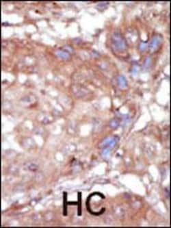 Invitrogen ACK1 Polyclonal Antibody 400 &mu;L; Unconjugated:Antibodies,