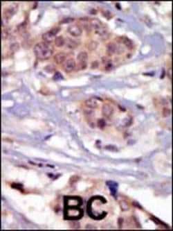 Invitrogen Fyn Polyclonal Antibody 400 &mu;L | Buy Online | Invitrogen&trade; | Fisher Scientific