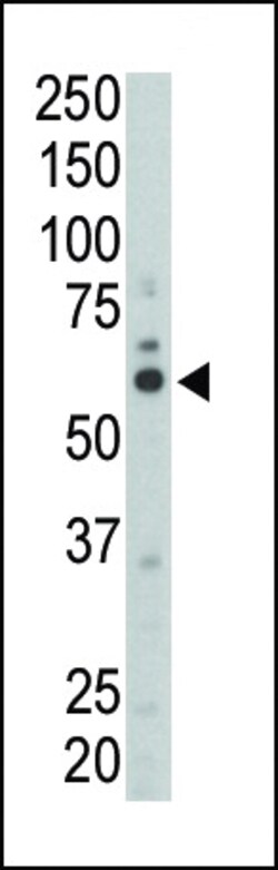 Invitrogen Fyn Polyclonal Antibody 400 &mu;L | Buy Online | Invitrogen&trade; | Fisher Scientific