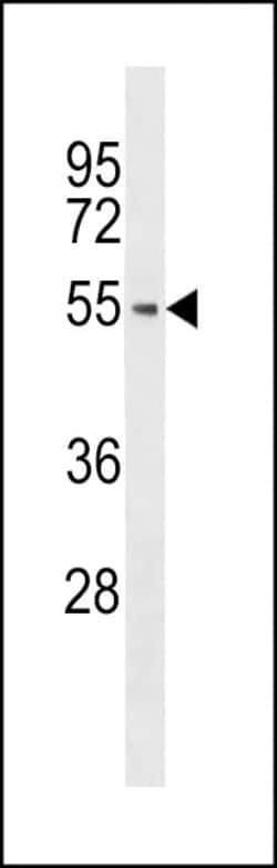 Invitrogen BRK Polyclonal Antibody 400 μL; Unconjugated:Antibodies,