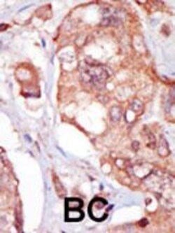 Invitrogen TNK1 Polyclonal Antibody 400 &mu;L; Unconjugated:Antibodies,