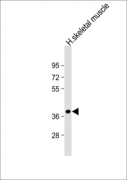 Invitrogen TRIB1 Polyclonal Antibody 400 &mu;L; Unconjugated:Antibodies,