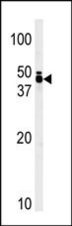 Invitrogen TRIB1 Polyclonal Antibody 400 &mu;L; Unconjugated:Antibodies,