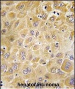 Invitrogen GRK7 Polyclonal Antibody 400 &mu;L; Unconjugated:Antibodies,