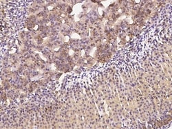 Invitrogen Clathrin Heavy Chain Polyclonal Antibody 100 &mu;L | Buy Online | Invitrogen&trade; | Fisher Scientific