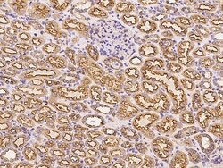 Invitrogen Clathrin Heavy Chain Polyclonal Antibody 100 &mu;L | Buy Online | Invitrogen&trade; | Fisher Scientific