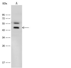 Invitrogen B1 Bradykinin Receptor Polyclonal Antibody 100 &mu;L; Unconjugated:Antibodies,