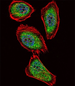 Invitrogen PDX1 Polyclonal Antibody 400 &mu;L; Unconjugated:Antibodies,