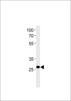Invitrogen PDX1 Polyclonal Antibody 400 &mu;L; Unconjugated:Antibodies,