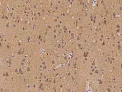 Invitrogen ATP6V1F Polyclonal Antibody 100 &mu;L; Unconjugated:Antibodies,
