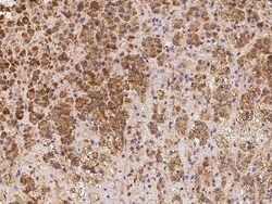 Invitrogen LRRC19 Polyclonal Antibody 100 &mu;L | Buy Online | Invitrogen&trade; | Fisher Scientific