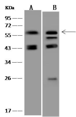 Invitrogen PPM1B Polyclonal Antibody 100 &mu;L; Unconjugated:Antibodies,