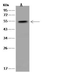 Invitrogen SNX31 Polyclonal Antibody 100 &mu;L | Buy Online | Invitrogen&trade; | Fisher Scientific